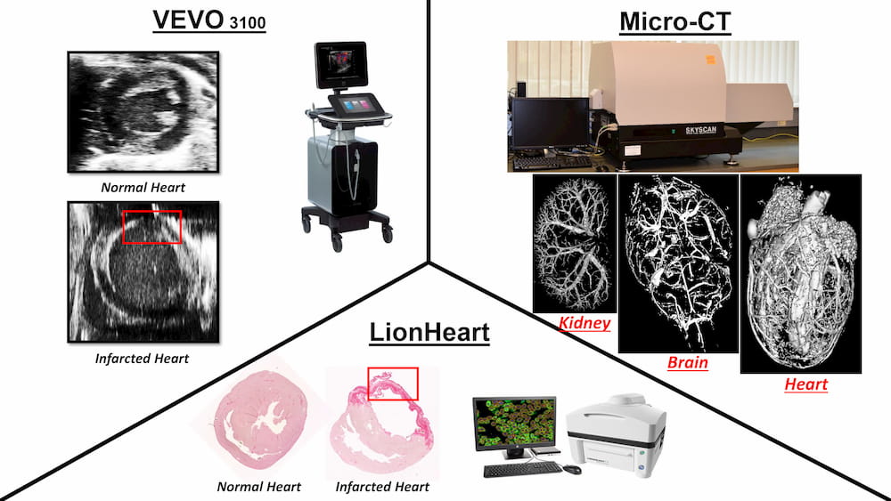 Imaging Core: VEVO 3100 equipment (Normal vs Infarcted Heart images). Micro-CT equipment (Kidney, Brain, Heart images). LionHeart equipment (Normal Heart, Infarcted Heart images).